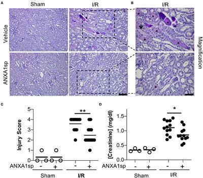 Annexin A1 Tripeptide Mimetic Increases Sirtuin-3 and Augments Mitochondrial Function to Limit Ischemic Kidney Injury